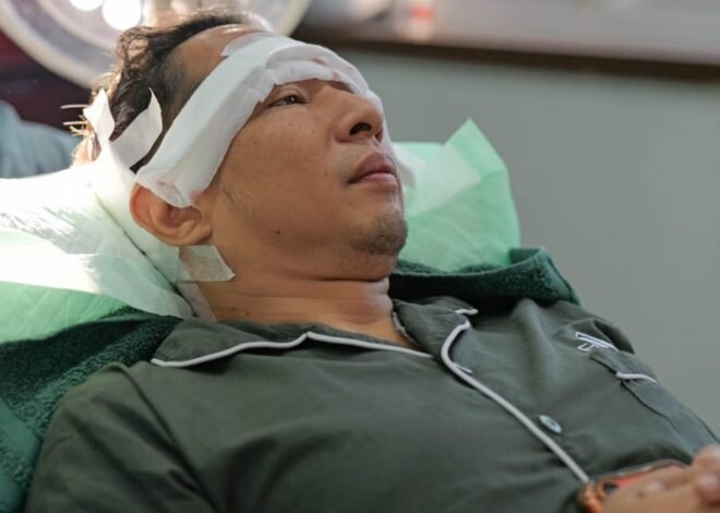 Ringgo Agus Rahman Jalani Transplantasi Rambut Tahap Kedua, Siapkan Penampilan untuk Karakter Baru