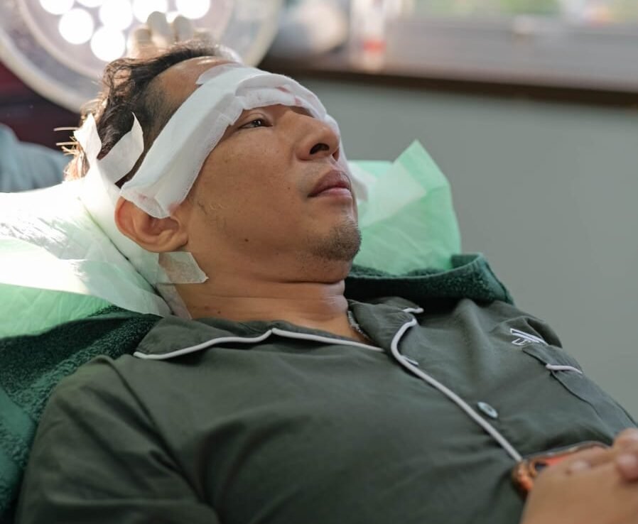 Ringgo Agus Rahman Jalani Transplantasi Rambut Tahap Kedua, Siapkan Penampilan untuk Karakter Baru